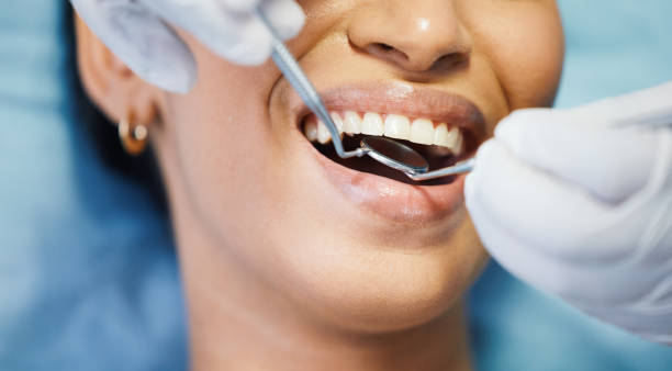 Best Emergency Root Canal Treatment in Royal Oak, MI
