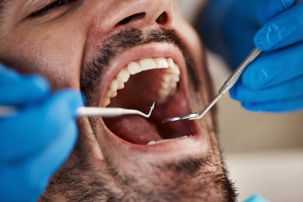 Best 24-Hour Emergency Dentist in Royal Oak, MI